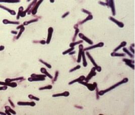 CLOSTRIDIUM TETANI