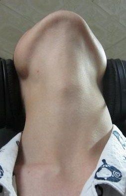 좆목.jpg