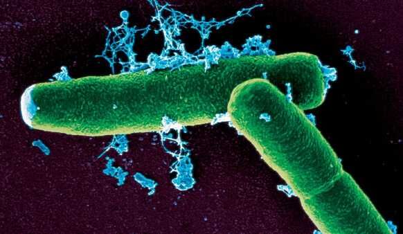 Anthrax-bacteria.jpg