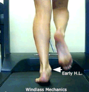 Windlass-Mechanics-Left-Foot-PCFD