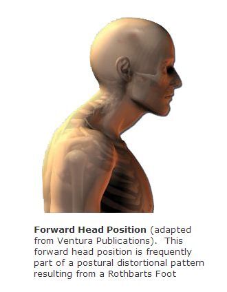 Forward head posture and respiratory function of each group