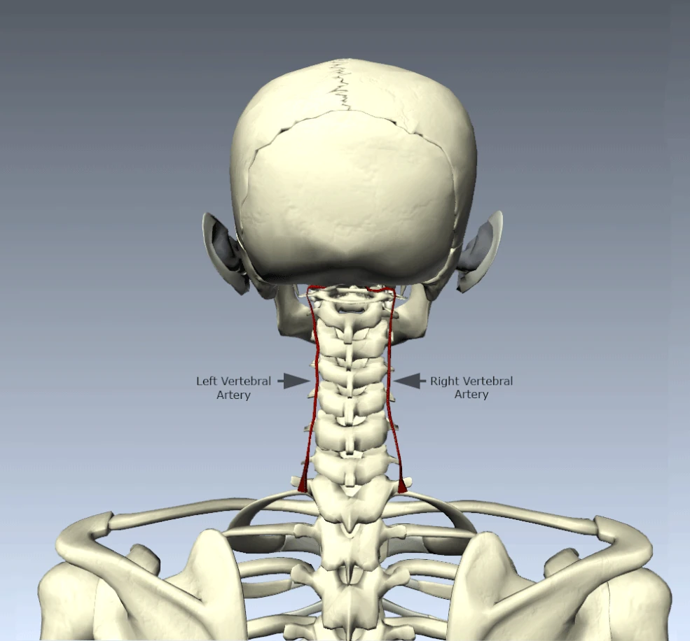 Atlas Laterality (Head Tilt) Linked to Cerebral Hypoxia