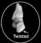 Twisted Heel Bone