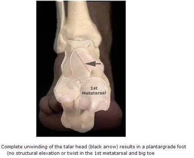 Metatarsus Normalus