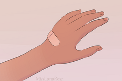 LR23 Z Injured Hand