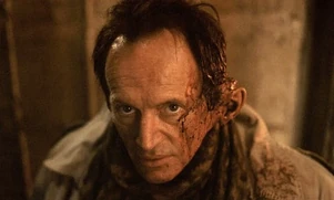 Майкл после нападения Фрэнсиса Аарона