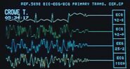 A Marine ECG readout screen inside an M577.