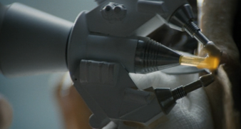 Laser scalpel Alien film