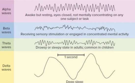 This image is of a schematic of typical brain waves detected by the electroencephalogram (EEG).