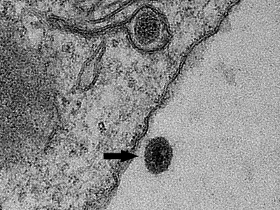 Entity 1 the Disease