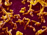 Hydrolitis Plague