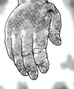 Poison Hand in the manga.