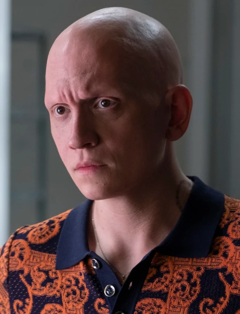 Barry': Anthony Carrigan on alopecia, discouraged in acting