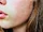Combination Skin