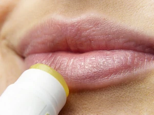 Lips-3141753 640