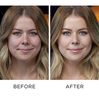 ColorCorrect BeforeAfter Redness