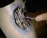 How-to repair a bionic leg