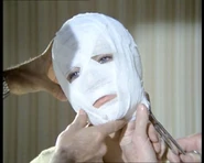 The moment of truth: removing the bandages