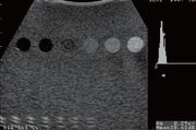 Ultrasound QA image