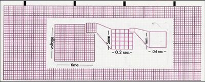 Chart strip