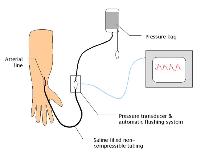 a. Non-invasive blood pressure measurement b. Invasive blood pressure