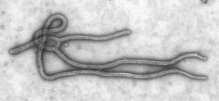 1280px-Ebola Virus TEM PHIL 1832 lores