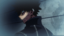 Dabi tells Kyudai how he managed to survive