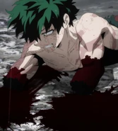 Izuku loses his arms.