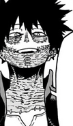 Dabi expresses joy over his actions.