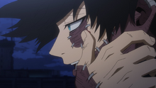Why Did Dabi' s Hair Turn White (dabi, hair, turn, white, This attack allows Dabi) Why Did Dabi' s Hair Turn White