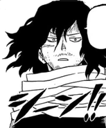 Шрам (после инцидента в U.S.J)