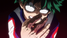 Izuku injured facing Shoto