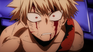 Bakugo's confused and shocked look