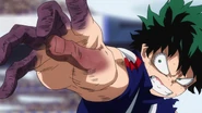 Izuku and his reckless Quirk