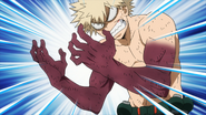 Katsuki with broken arms