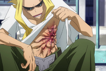 Toshinori shows his stomach wound