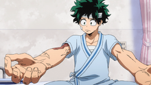 Izuku's damaged arms