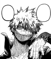 Dabi reveals his true identity as Toya Todoroki