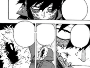 Geten notices Dabi's body burning