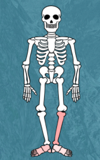 Body Damage Broken Bones Iv Wiki Fandom - roblox broken bones 4 tips