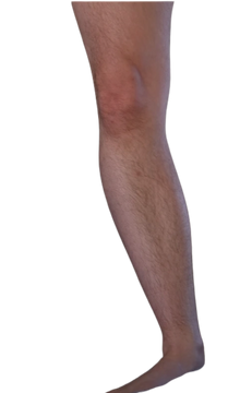 Wiki leg top