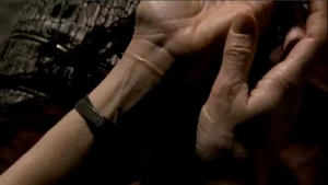 Amanda looks at her scars from a past suicide attempt.
