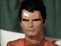 Captain Scarlet recovering