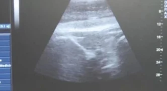 Kamea ultrasound2