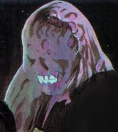 Burns.png (96 KB) Burns