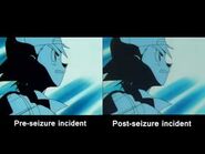 Before and after Pokemon Shock incident comparison- Episode 1
