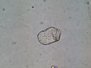 Phytolithe-buliforme