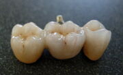 Bridge from dental porcelain