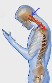 Text neck