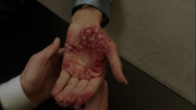 1x14 Pain Resistance